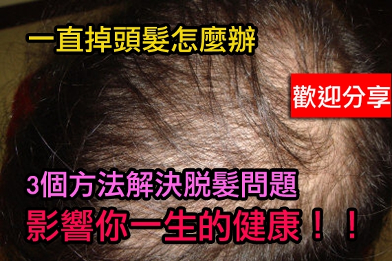 <em>头发掉</em>的厉害<em>怎么</em>办3个方法<em>解决</em>脱发问题 LIF