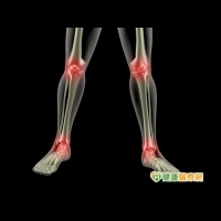 孩子膝關節疼痛　小心幼年型自發性關節炎