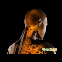 長期脖子痠痛　小心是骨刺造成