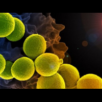 動物實驗發現：脂質體可打敗超級細菌