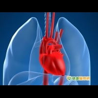 冠狀動脈心臟病　引發血管栓塞機率高