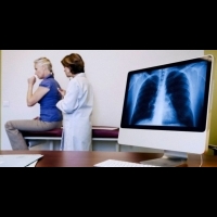不吸菸女性得肺腺癌 20 年成長五倍 早期發現九成五可存活 | 健康達人網
