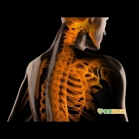 脊椎骨折要小心　嚴重恐易癱瘓