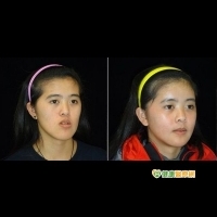 正顎治療激勵　台灣網球選手迎向人生大滿貫