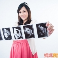 認識胎兒頸部透明帶｜媽媽寶寶