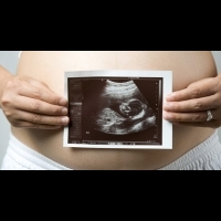 一次解答孕產婦最想知道的10件事 | 早安健康NEWS