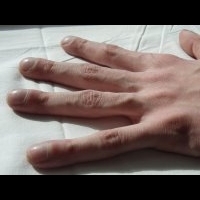 8個指甲問題透露健康警訊，彩繪前先看仔細 | 早安健康NEWS