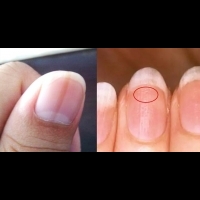 看壽命不用找算命的 手指甲就能告訴你