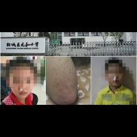 驚人！小學生跑步跑到流鼻血，原因出在他們腳底下...太可惡了！！