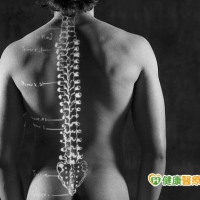 長期下背痛　恐是僵直性脊椎炎所致