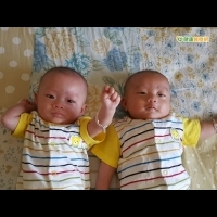 亞洲首例！　罕見5胞胎異位懷孕