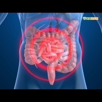 男性貧血　恐和腸胃道出血有關