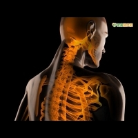 肩關節長期無力　原來是椎間盤病變惹禍