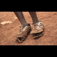 在肯亞的沙蚤侵蝕孩子們的雙腳，在台灣讓你發現需要鞋子的人