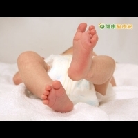 新生兒髖關節脫臼　恐導致日後長短腳