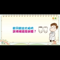 蛀牙蛀出大陷坑　該填補還是嵌體醫師這樣說｜認識疾病 蛀牙篇2
