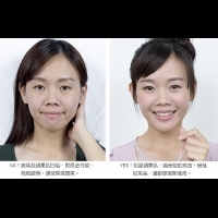 情變激瘦,不只傷了心,也削瘦了臉頰!