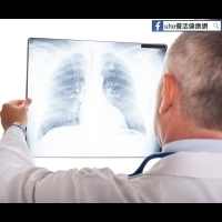 咳3天肺感染　安心過年快接種