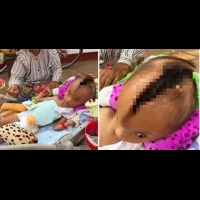 他一出生就「頭就有洞」還愈破愈大甚至連「爸爸都不要他」，沒想到阿嬤竟發現這裂縫的暗黑真相？！