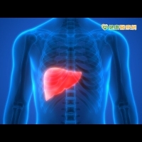 脂肪肝有藥可醫　第三期臨床試驗中