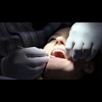 牙醫師警告切勿自行矯正牙齒