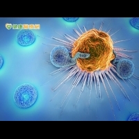 腎臟癌腦轉移　免疫療法抗癌立大功！