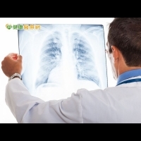 肺癌新一代化療藥物副作用少　醫囑性高提升療效