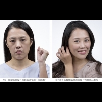 終結凶凶老態,像玫瑰般璨爛綻放!