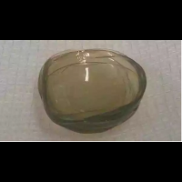 67歲老太眼中取出了27片隱形眼鏡!醫生:還有這種操作?!