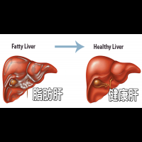 台灣3分之1人口有「脂肪肝」問題，「逆轉脂肪肝」的7大絕招，救肝降脂不能再拖！