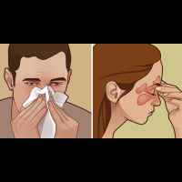 「過敏」一發作鼻涕擤不完？8個「天然妙招」幫你打擊過敏，大口呼吸不是夢！