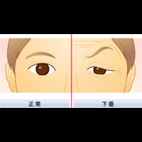 別向老化屈服！改善「眼瞼下垂」不必開刀，5種居家保養妙招讓它恢復原形。