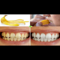 告別「黃牙」免花錢：「5種天然原料」有效除垢，還你一口潔淨白牙！｜每日健康 Health