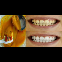 滿口「黃牙」有救了：「薑黃」加上「兩種常見材料」這樣刷，黃垢、齒斑瞬間消失，美白效果看得見！