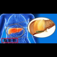 血脂一高肝就中招，不要再讓肝哭泣了！少吃這些食物，「脂肪肝」也可逆轉勝！