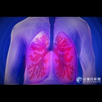 肺癌連年死亡第一名　兩大廠著力肺癌精準醫療