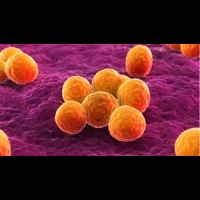 細菌和病毒感染有什麼區別？