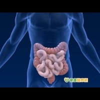 腸道長息肉　大腸癌機率高達三成