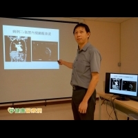支氣管內視鏡超音波　有效提高肺癌診斷率