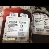 輸血更安全！　減白血品降低不良反應