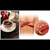 咖啡可降低罹患「肝癌」和「子宮內膜癌」發生　有力證據顯示：「這些食物」會降低癌症風險