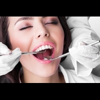 美甲師做美齒療程 小心換來一口爛牙