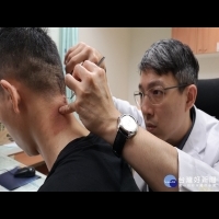 越籍男子高位頸椎腫瘤壓迫險癱瘓　彰基顯微影像手術成功治癒