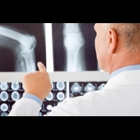 定期檢測骨密度遠離骨鬆 超音波篩檢值得參考