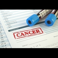 癌症檢測再躍進 血液篩檢準確預測癌細胞轉移