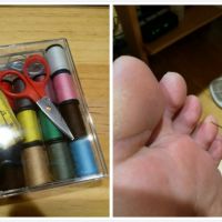 媽祖遶境途中,腳底起水泡怎麼辦?6步驟,如何先緩解痛苦...
