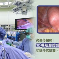 子宮肌瘤阻擋好孕 3D腹腔鏡微創手術排除障礙
