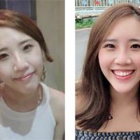打敗冏字臉,就靠洢蓮絲來解套吧!