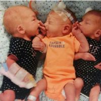 美國胖婦以為腎結石 卻生下三胞胎