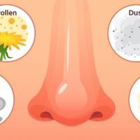 如何分辨鼻過敏與鼻竇炎？ 專家教你看鼻涕顏色秒懂